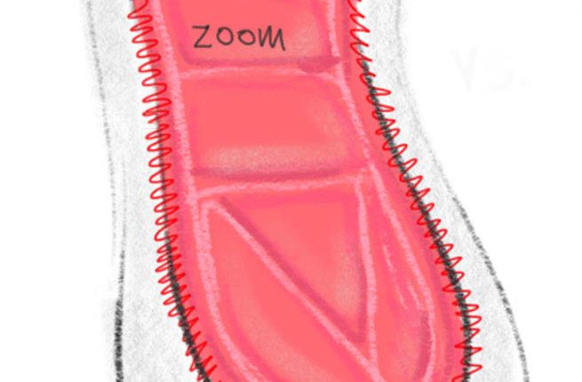 Zoom Strobel